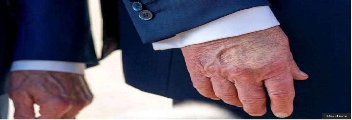 Политические и социальные последствия болезни Трампа