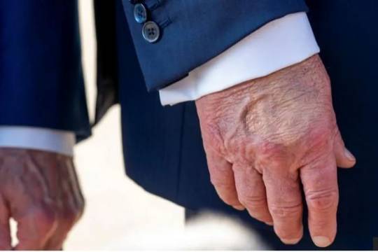 Политические и социальные последствия болезни Трампа