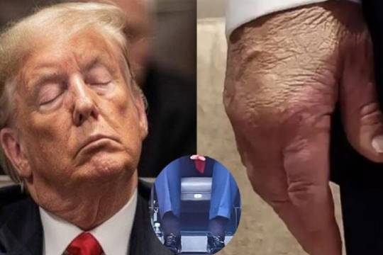 Trump’s COVID Crisis: A Symptom of America’s Decaying Political System